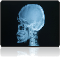 rentgen czaszki